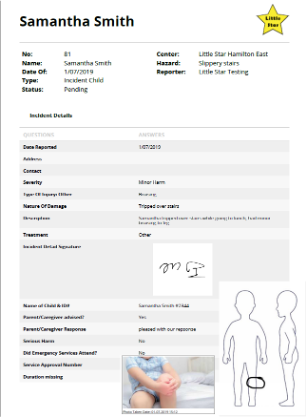 making incidents easier